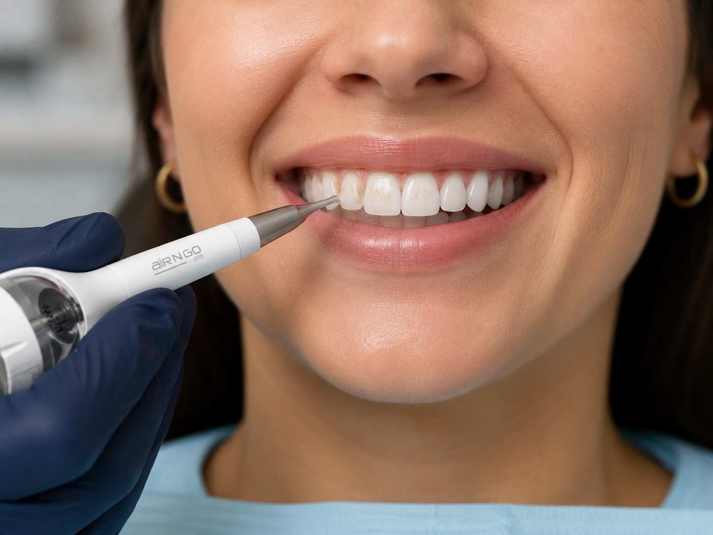 Air polishing used to remove external tooth staining