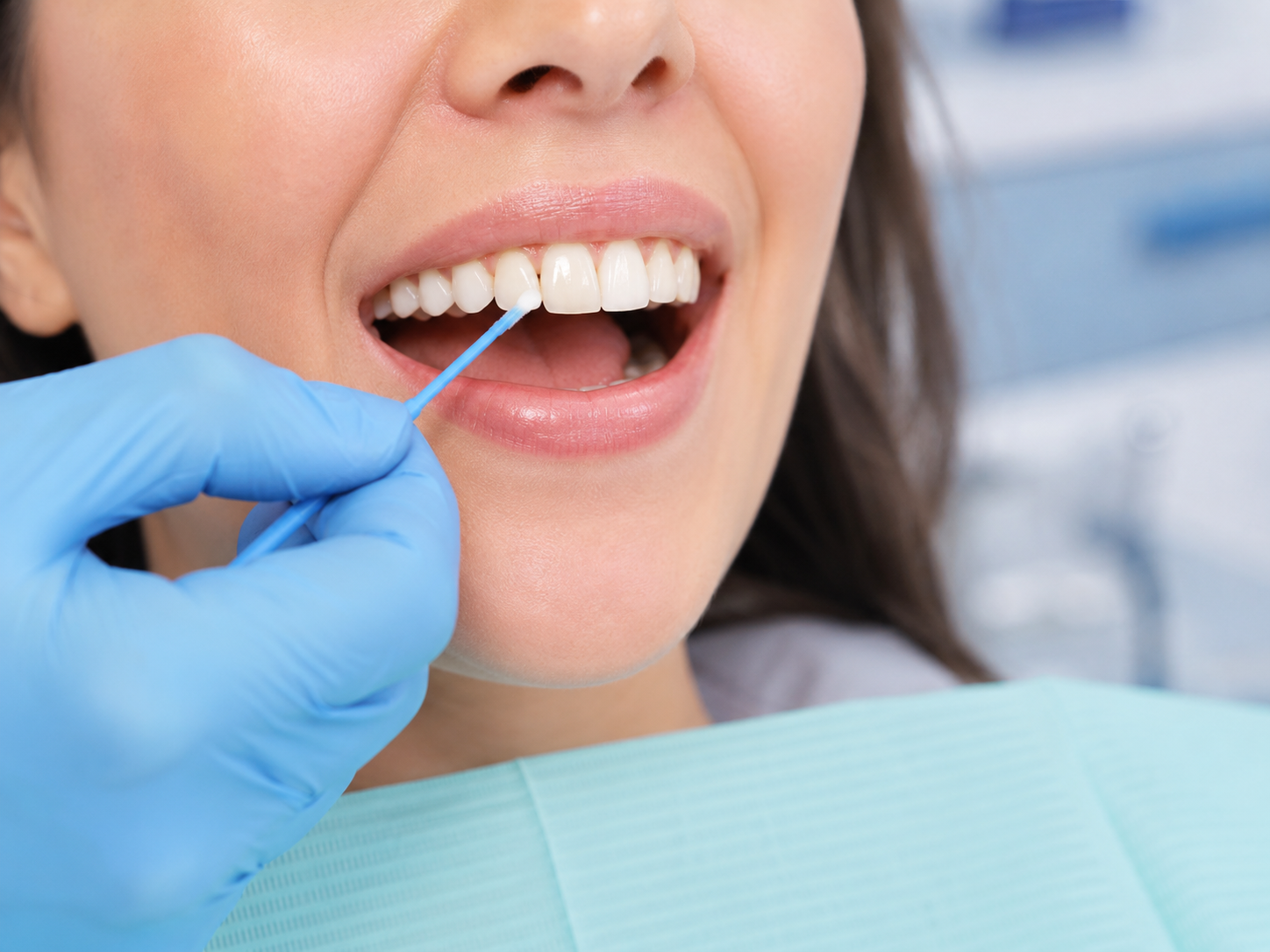 Fluoride varnish being applied to a patient's teeth